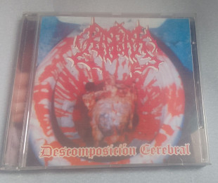 Kabak - Decomposicion Cerebral