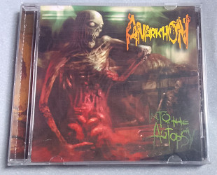 Anarkhon - Into The Autopsy