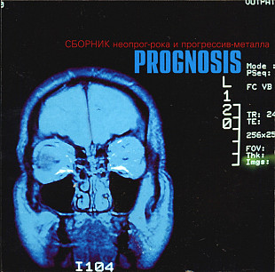 Prognosis. Сборник Неопрог-Рока И Прогрессив-Металла ( Stereo & Video , CD-Maximum – S&V 070