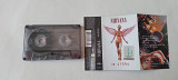Nirvana in utero